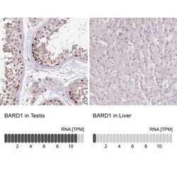 BARD1 Antibody, Novus Biologicals:Anticuerpos:Anticuerpos primarios